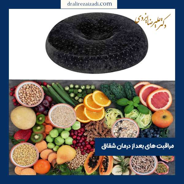 مراقبت های بعد از درمان فیشر