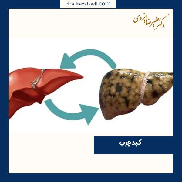 کبد چرب