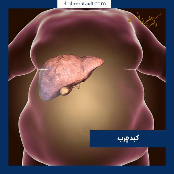 برای کبد چرب چی بخوریم؟