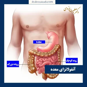 درمان قطعی آنفولانزای معده _ دکتر علیرضا ایزدی