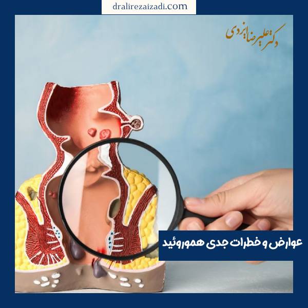 مرگ در اثر هموروئید