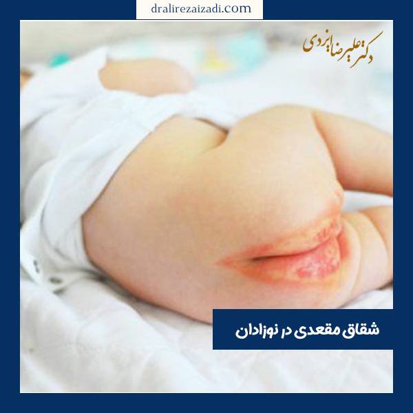شقاق مقعدی در نوزادان - دکتر علیرضا ایزدی