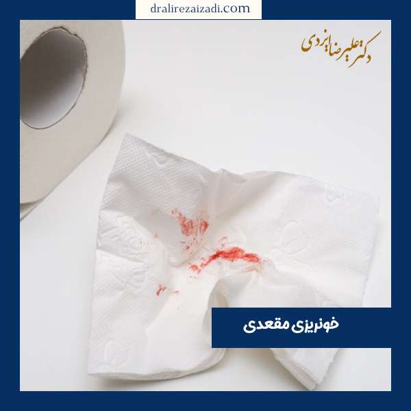 خونریزی مقعدی