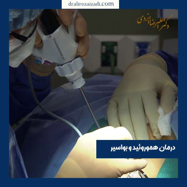 درمان بواسیر بیرون زده - دکتر ایزدی