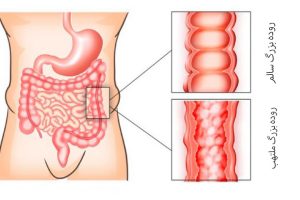 درمان عفونت روده در تهران _ دکتر علیرضا ایزدی