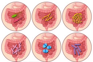 درمان عفونت روده در تهران _ دکتر علیرضا ایزدی