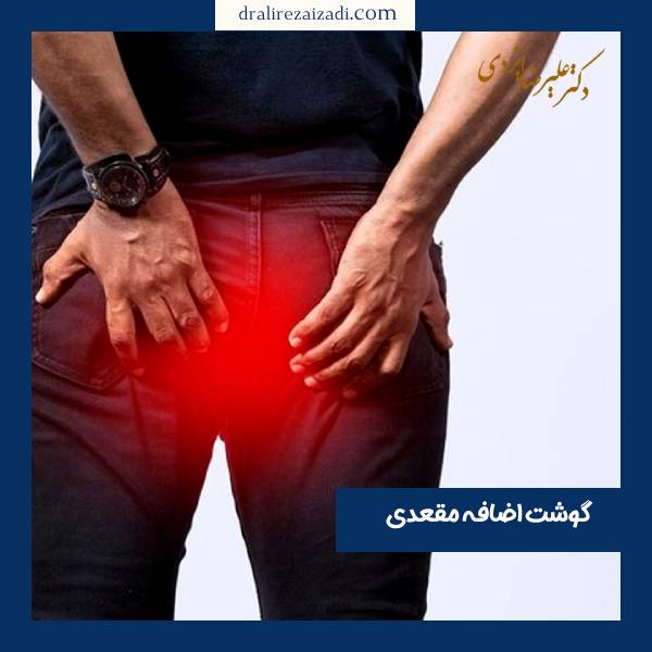 گوشت اضافه مقعد