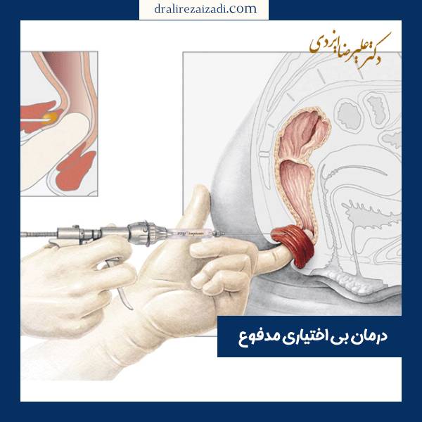 عکس بی اختیاری مدفوع