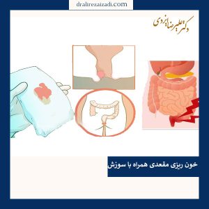 عکس خون ریزی مقعدی هرماه با سوزش _ دکتر علیرضا ایزدی