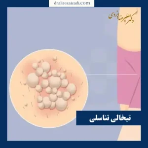 تبخال تناسلی _ دکتر علیرضا ایزدی