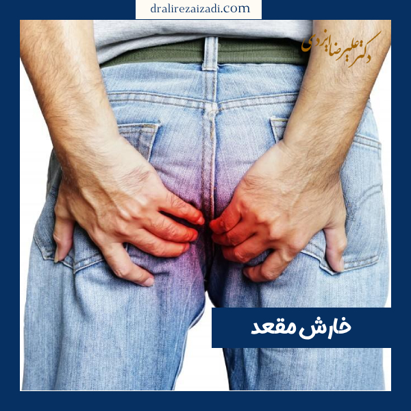 خارش مقعد - دکتر علیرضا ایزدی https://dralirezaizadi.com/
