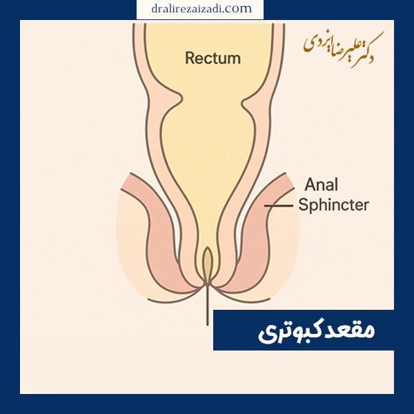 مقعد کبوتری - دکتر علیرضا ایزدی