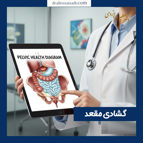 گشادی مقعد - دکتر ایزدی
