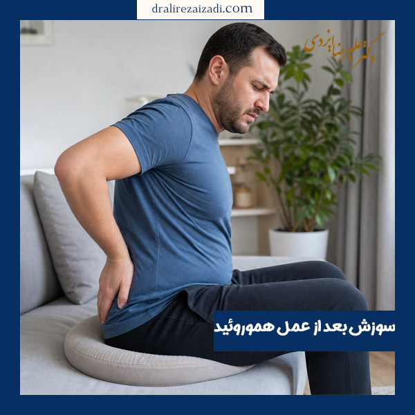سوزش بعد از عمل هموروئید - دکتر ایزدی